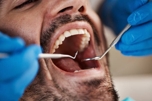 Best Emergency Cosmetic Dentistry in Stockton, MO