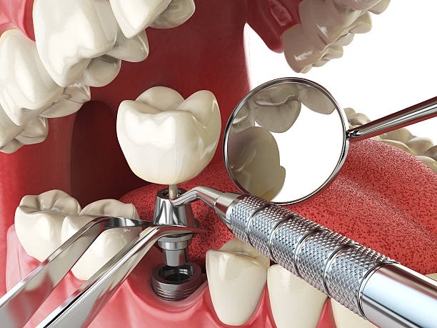 Best Orthodontic Emergency Dentist in Stockton, MO
